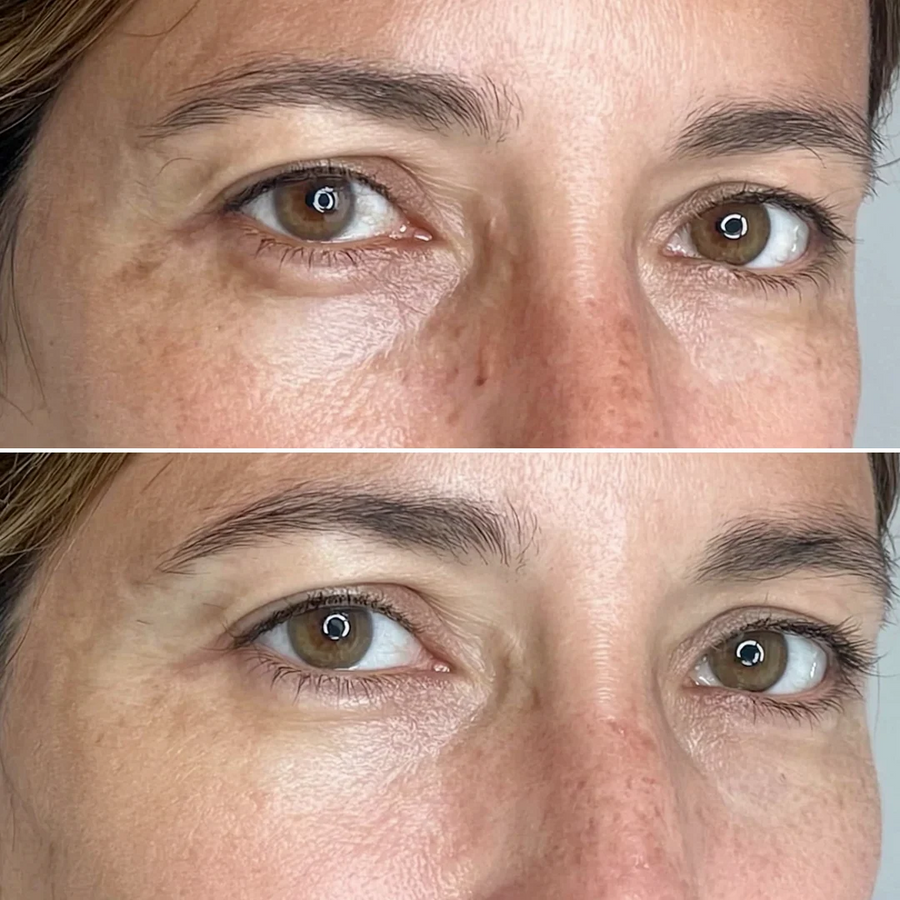 Before and after