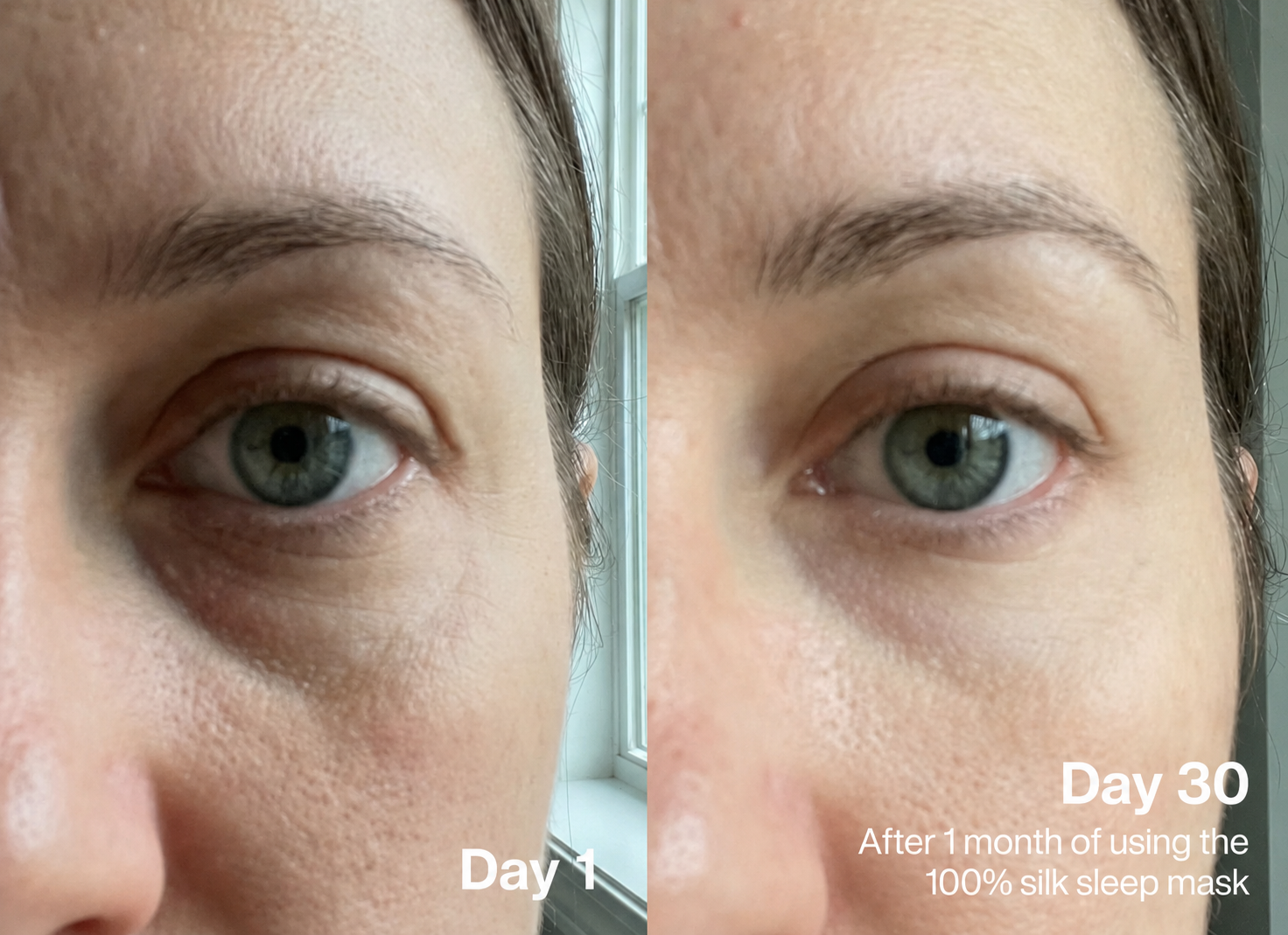 Day 1 versus day 30 results