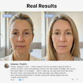 Cloud-Contour Night Mask