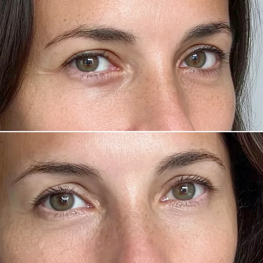Before and after
