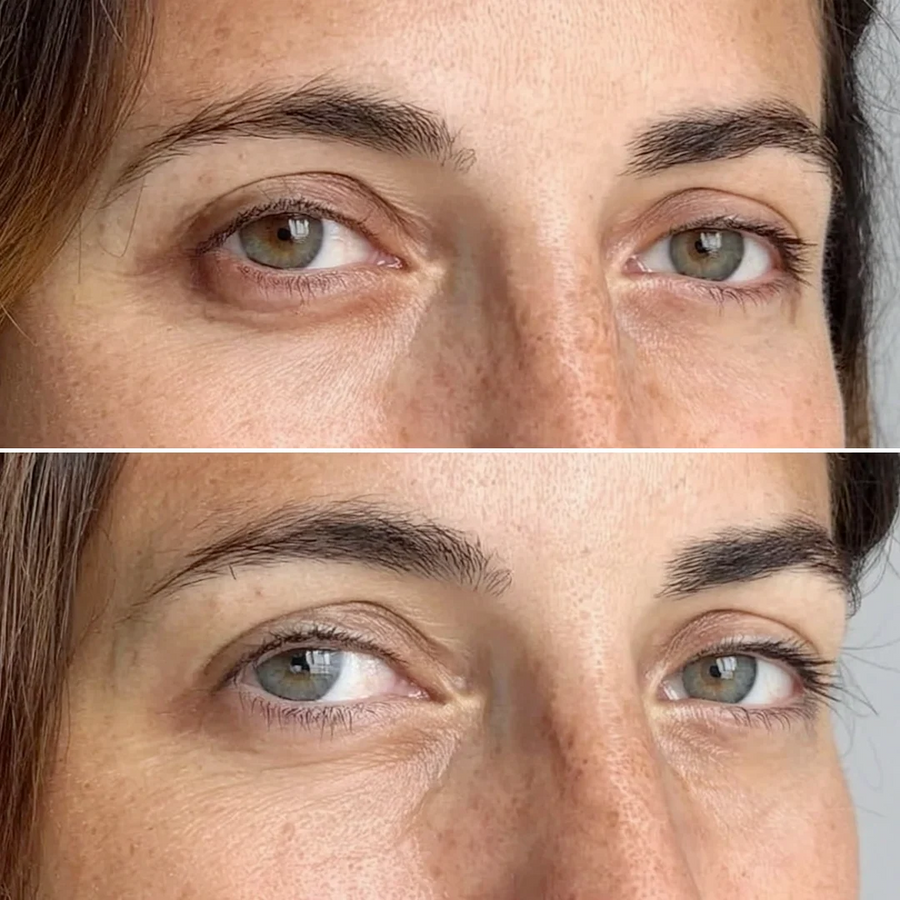 Before and after